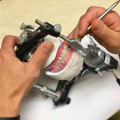 Denture Maintenance and Repairs